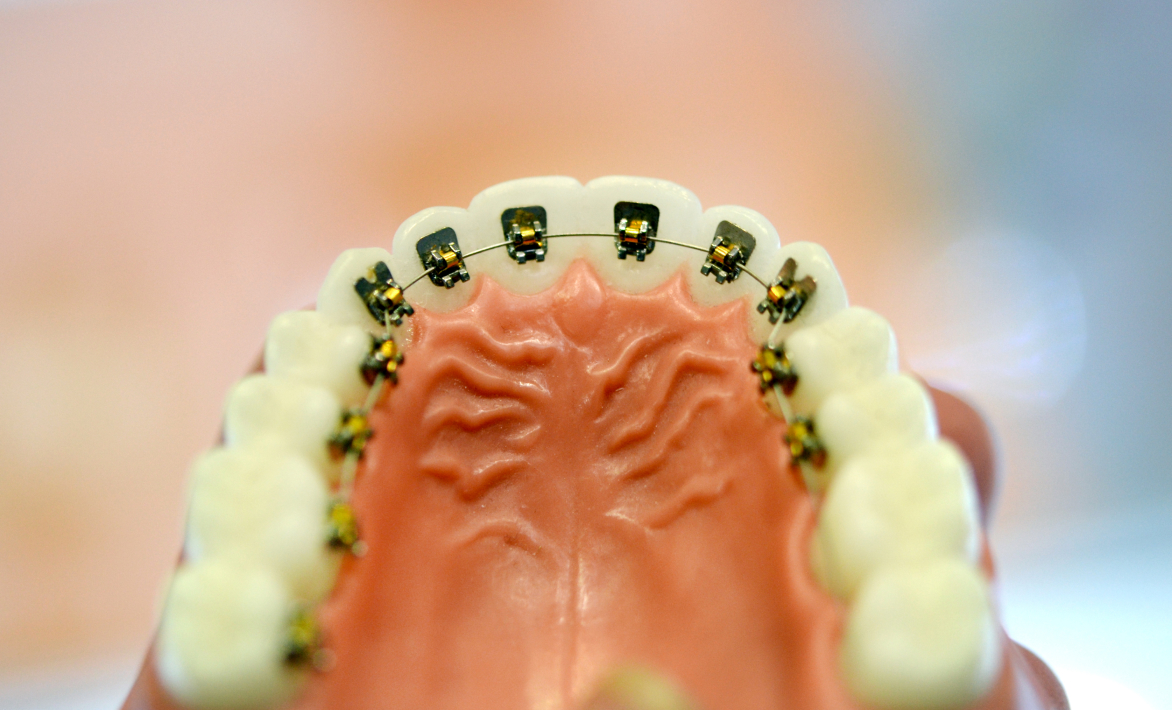 裏側矯正が得意な医院です